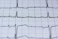 hyper node 2106401949 stellar pulse